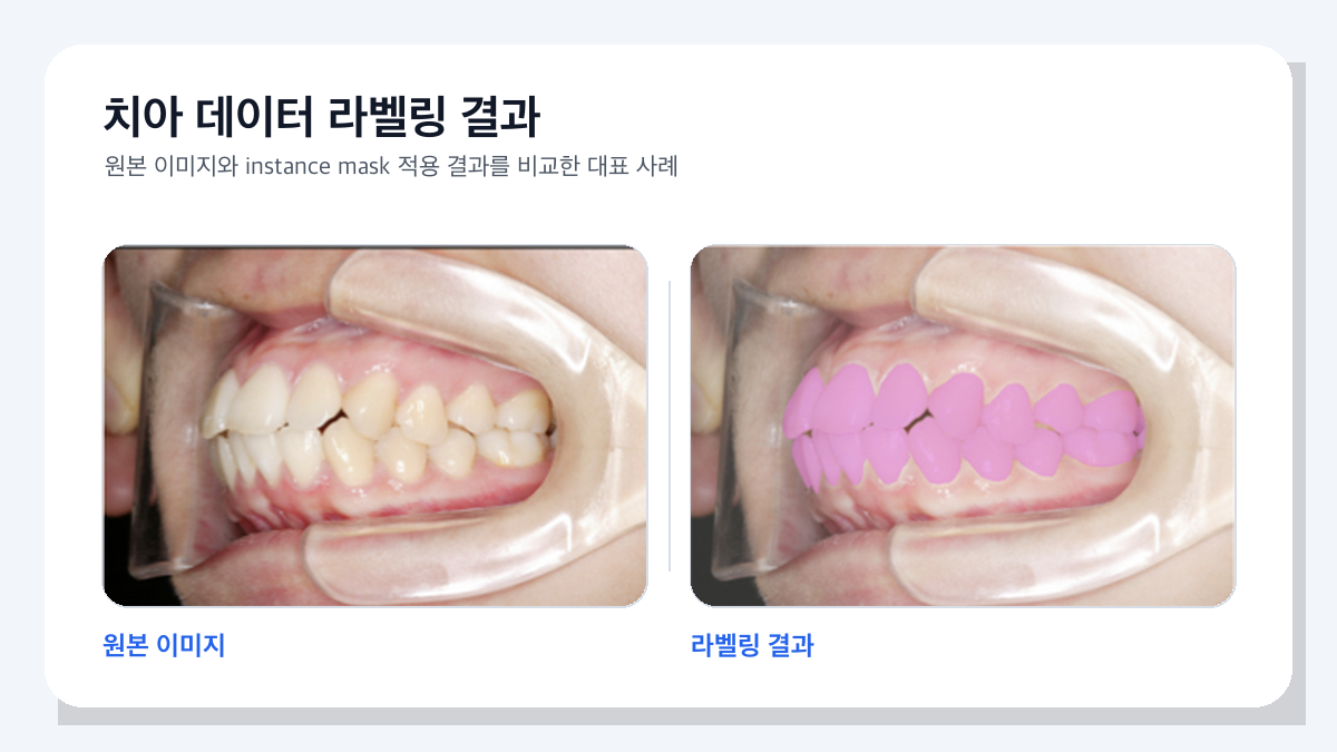 부정교합 파악 보조 AI 모바일 앱 메인 화면