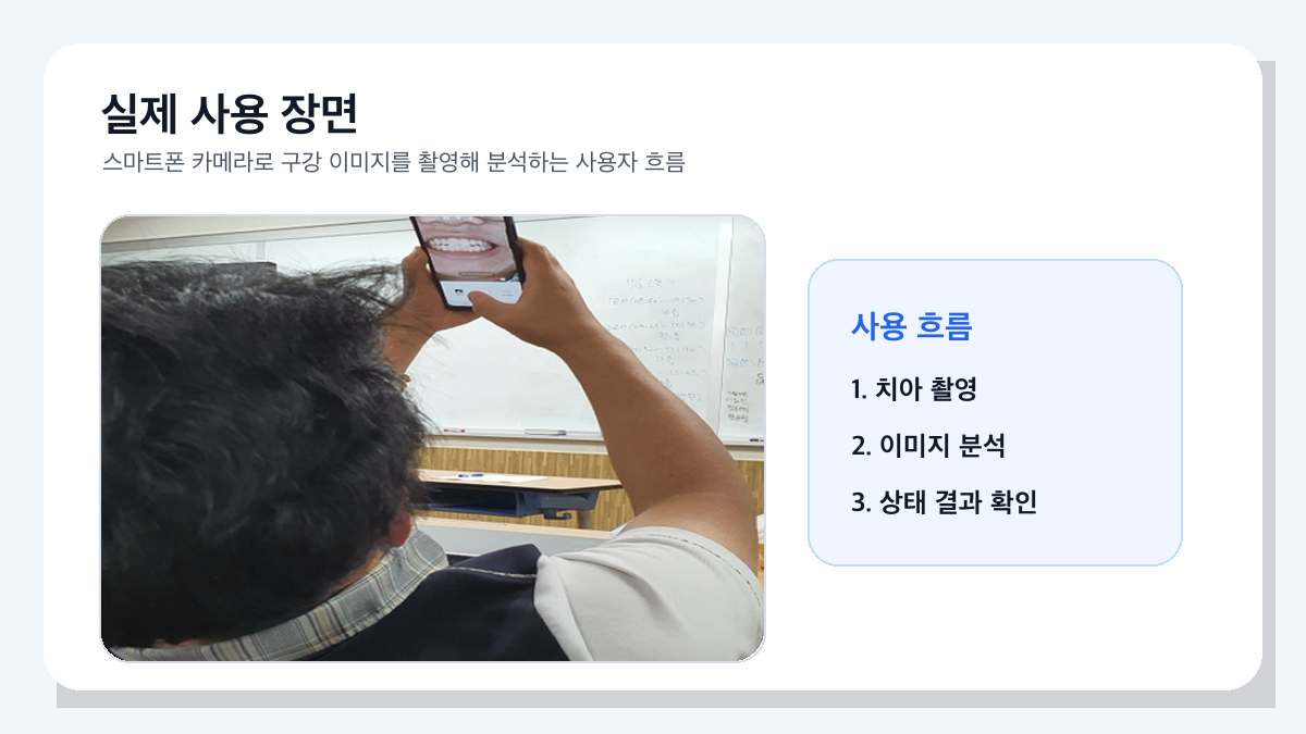 부정교합 분류 결과 화면